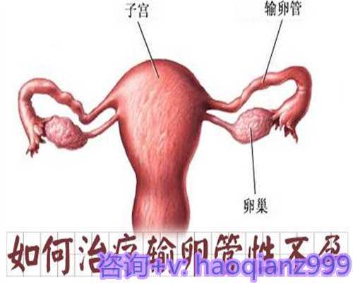 探讨盆腔炎的常见成因及防治之道