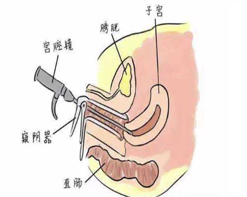 宝芝堂怎么联系？警惕冒牌客服的三代试管骗局